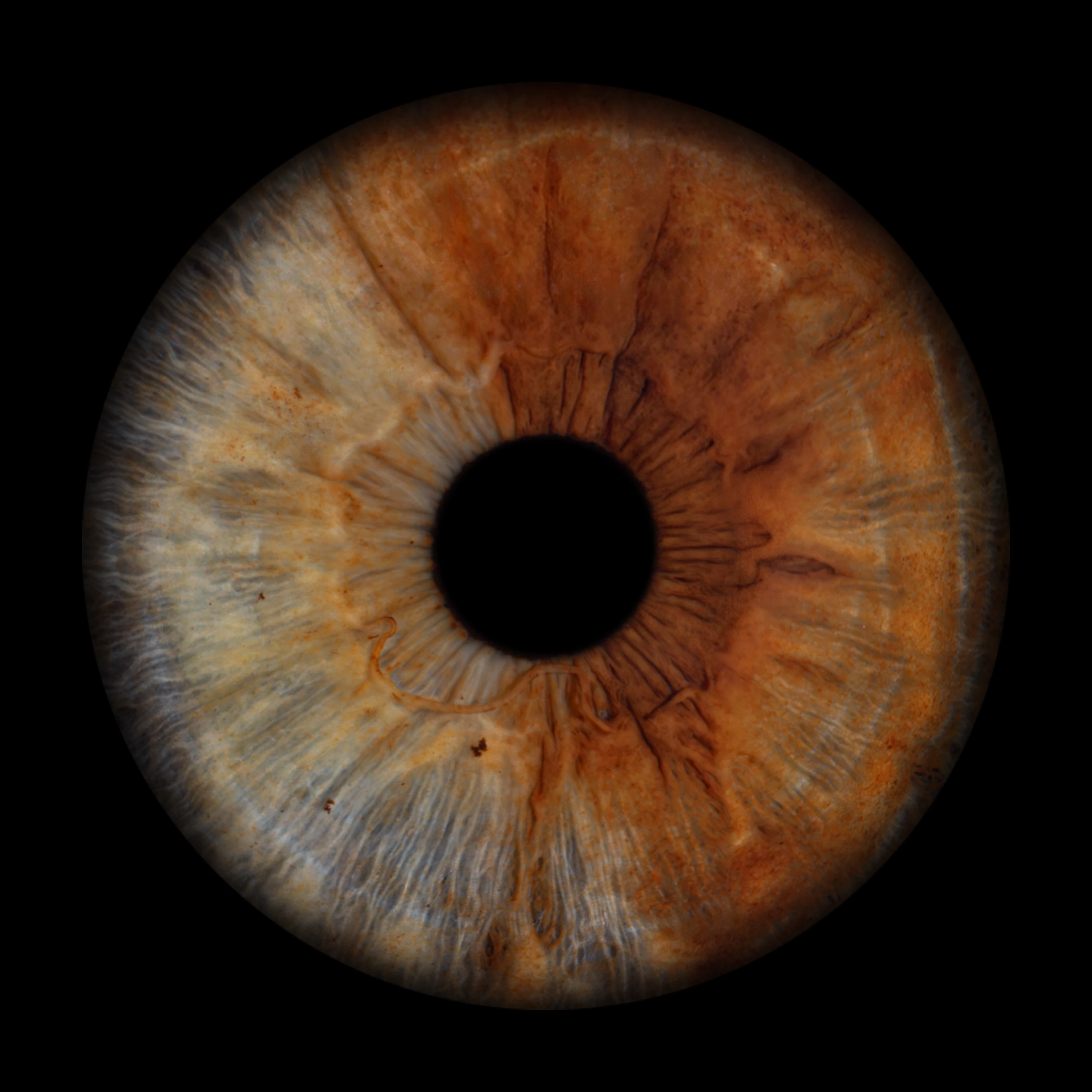 Heterochromia Iris