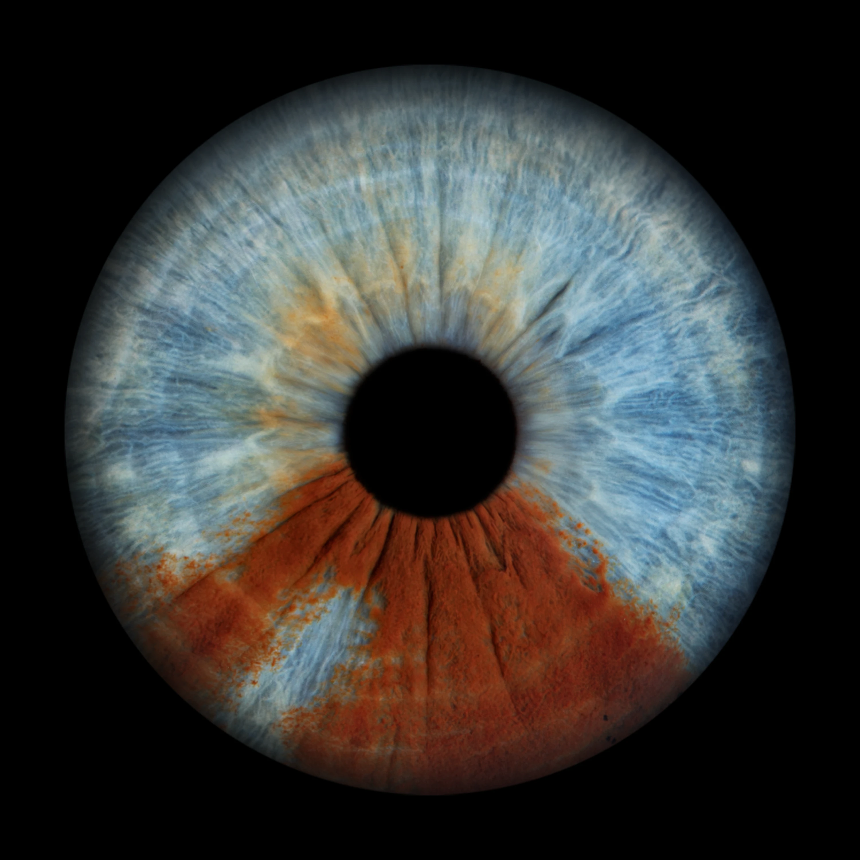 Heterochromia Iris