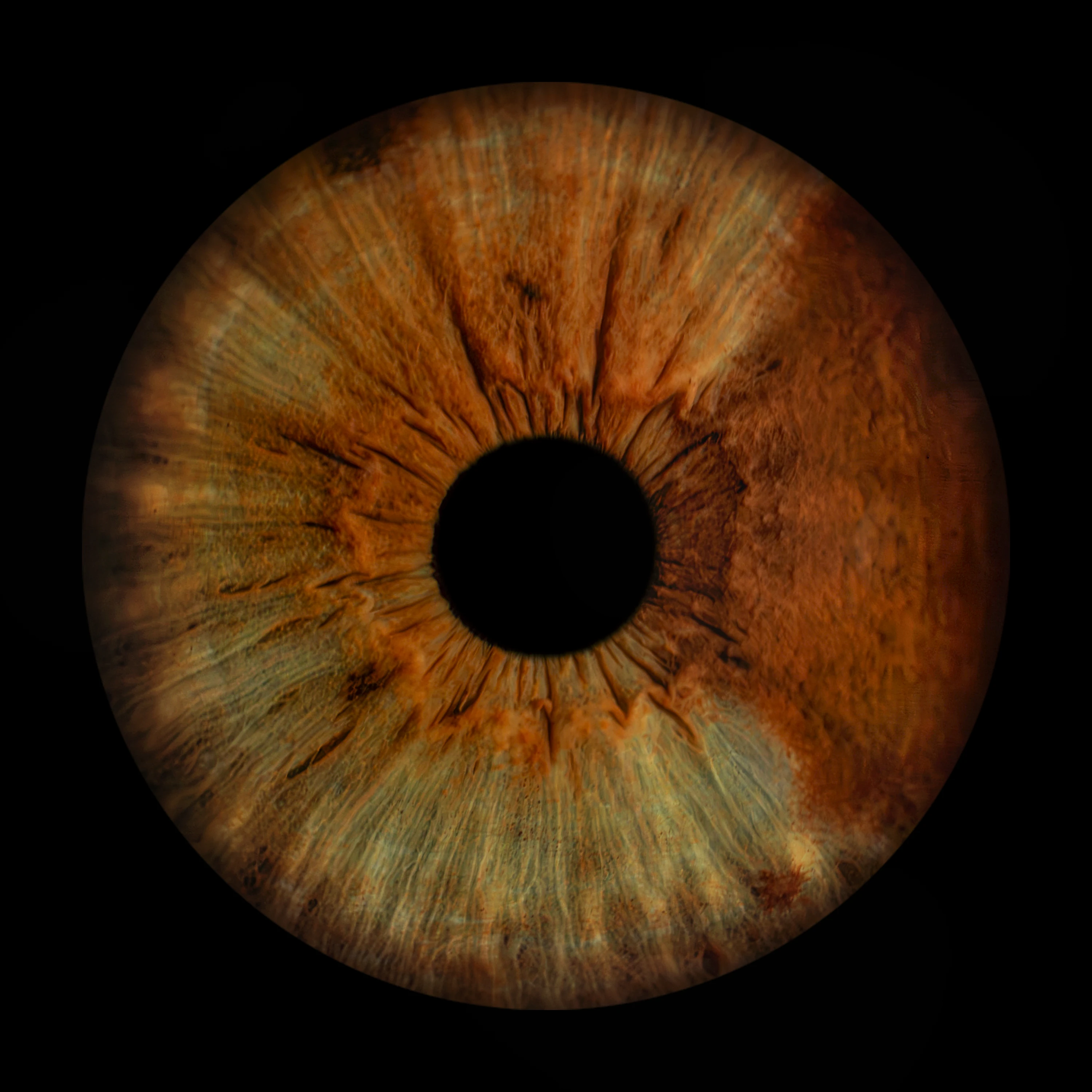 Heterochromia Iris