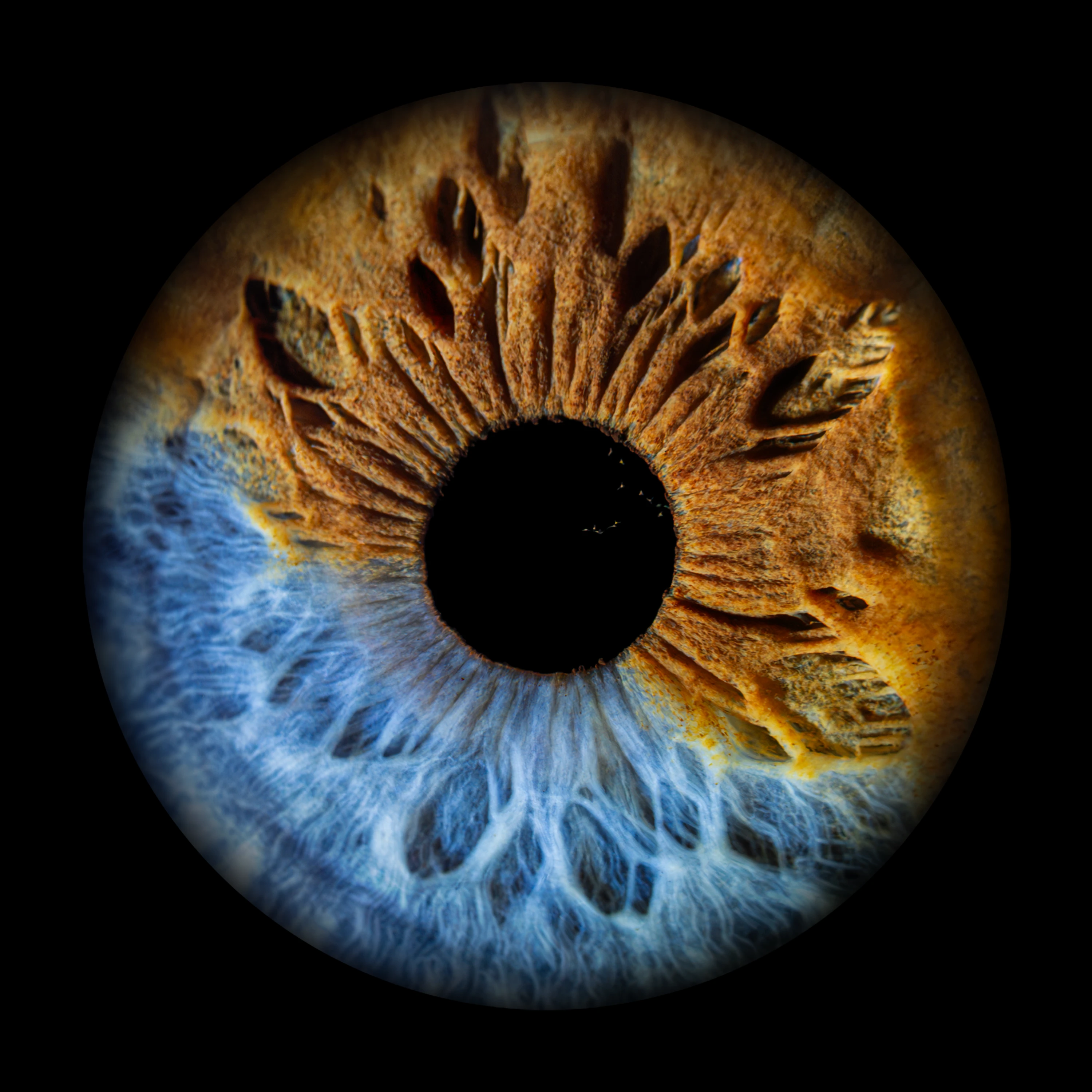 Heterochromia Iris
